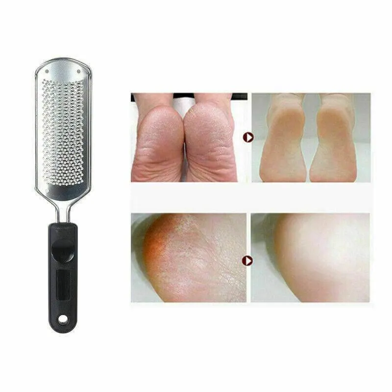 Pro 2 In1 Foot Callus Remover File Rasp Scraper Cracked Pedicure Rough Tool Colossal Foot Scrubber